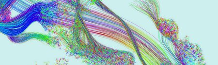 Basal ganglia