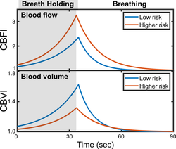 Two charts stacked on top of each other. Both show time along the x-axis. The y-axis shows blood flow in the top graph and blood volume in the bottom graph. Low risk patients are represented in blue, high risk patients are represented in red. During breath holding, in the graph above, the blue line rises to a lower peak than the red line before decreasing. In the chart below, it's the opposite: the blue line rises to a higher peak than the red line before declining.