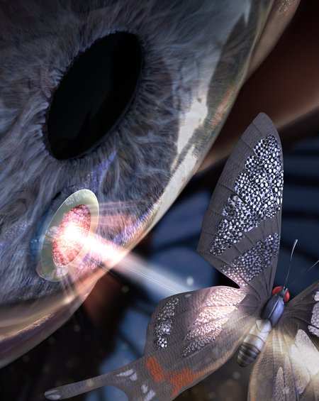 Eye implant