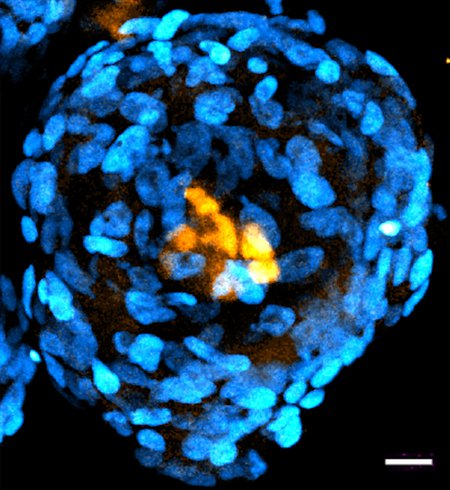 A spherical structure composed of blue oval-shaped cells, with a center of yellow cells