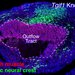 A chicken embryo heart with developmental defect