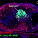 A six-day-old chicken embryo heart with neural crest cells labeled in green