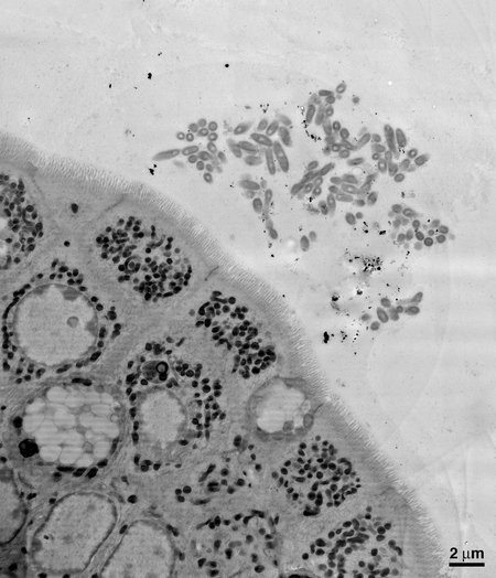 An electron microscopy image of a section of the mouse gut, showing B. fragilis aggregating close to the epithelial cells that make up the lining of the gut.