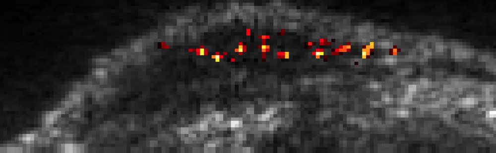 A pixelated black-and-white image of a tissue structure. Small spots representing individual cells are highlighted in yellow and orange.