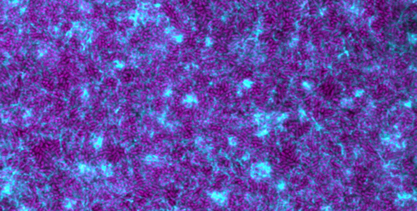 Many purple pill shapes among a web of blue