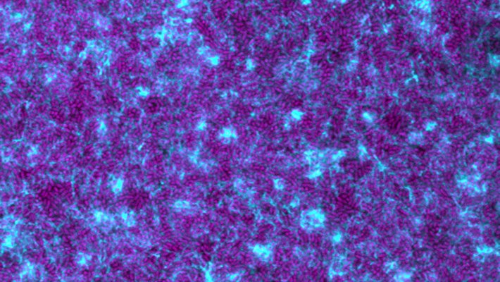 Many purple pill shapes among a web of blue