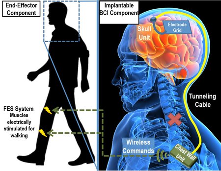 Algorithm may improve brain-controlled prostheses and exoskeletons