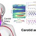 A graphic showing a purple box labeled "Esperto sensor" over the carotid artery. Ultrasound imaging shown along with measurements related to blood pressure in separate plots.